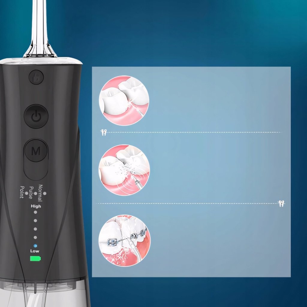 Irygator bezprzewodowy SURFOU 300ml 6 dysz IPX7 | REEVE